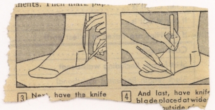 Lichtenstein’s Mail-Order Foot (1961) - Image Gallery